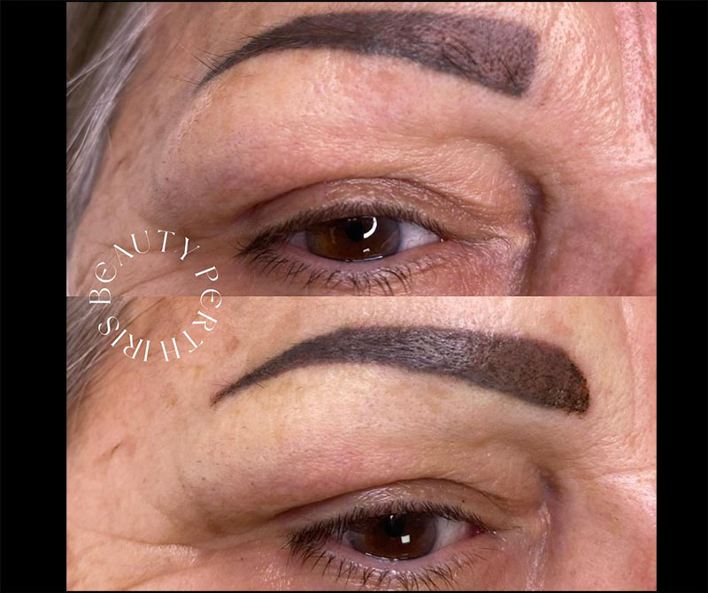iris-beauty-3-Skin-Treatment