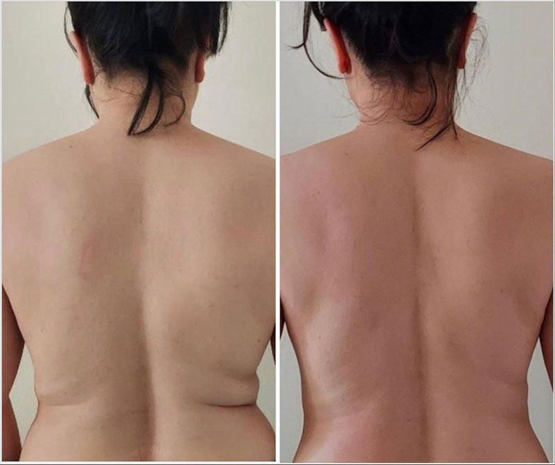iris-beauty-5-weight-loss